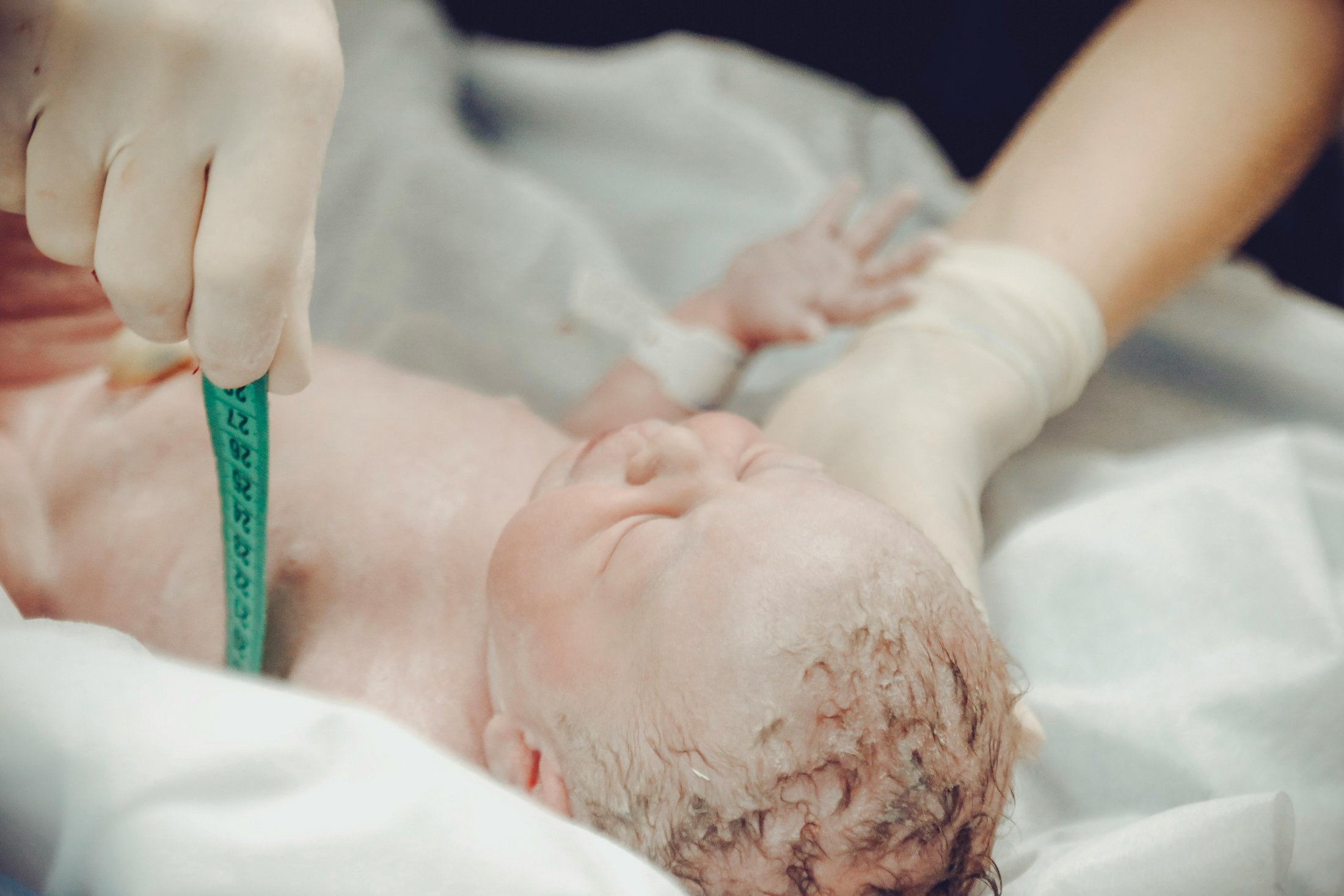 A newborn lying on a medical table immediately after birth, with healthcare professionals measuring the infant using a tape measure, highlighting the first moments of postnatal care.