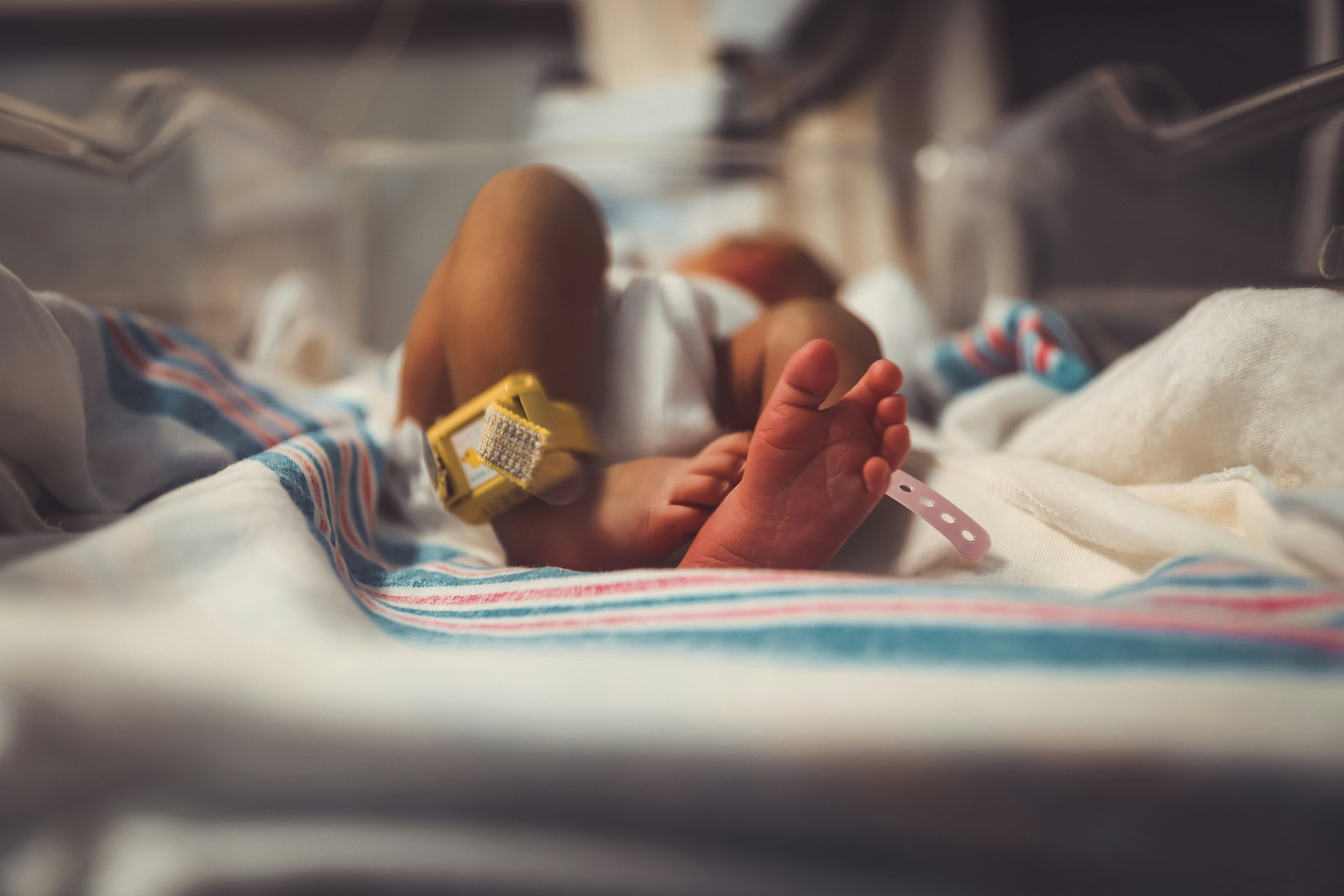 Neonatal Care After Preterm Birth Close-up of a newborn infant lying in a hospital bassinet with an identification band attached to the ankle. The image reflects neonatal care and the ongoing monitoring often associated with preterm birth.