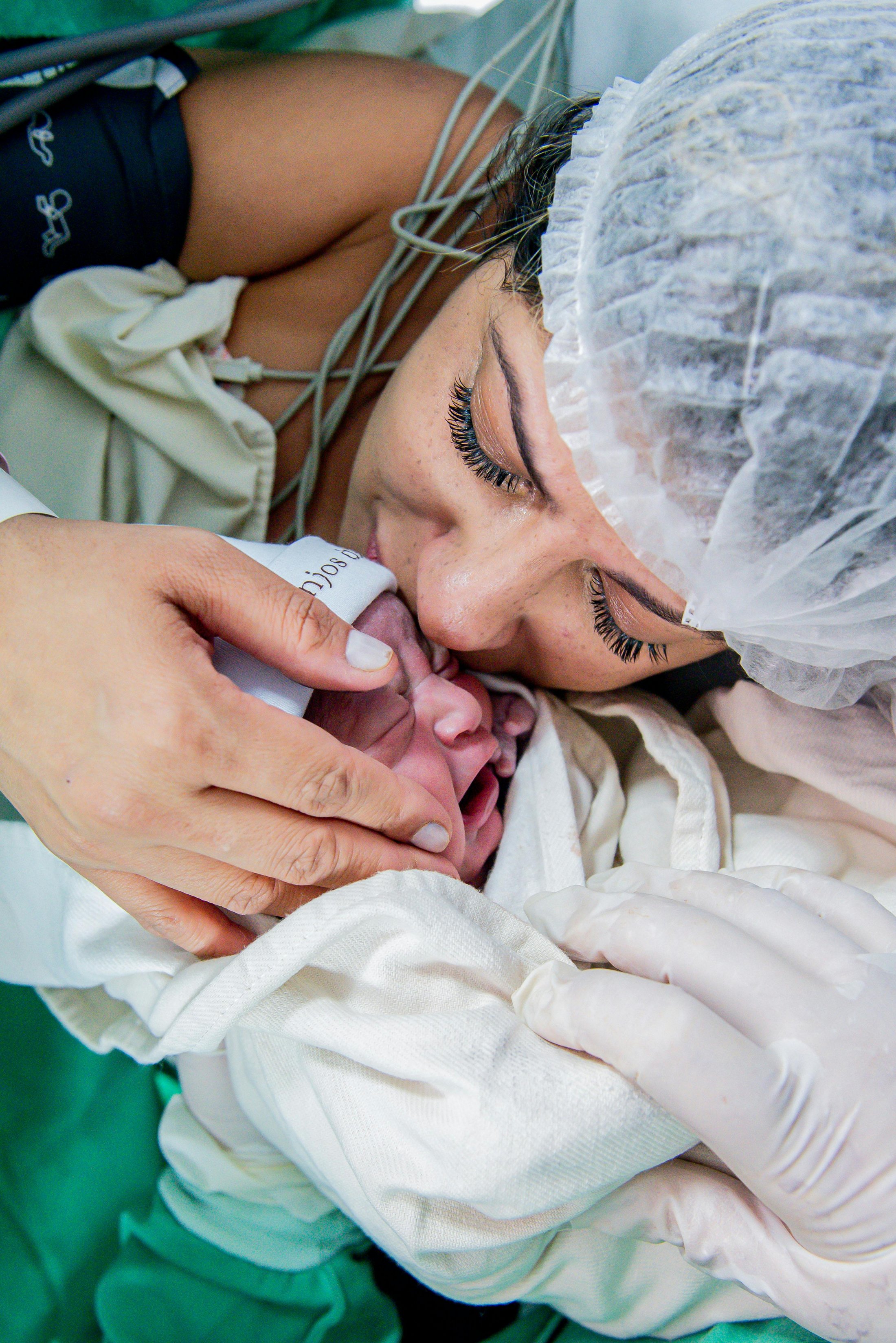 A mother wearing a surgical cap lovingly kisses her newborn immediately after birth in a hospital setting. The baby is wrapped in a white blanket and gently held, symbolizing the first moments of bonding and skin-to-skin care.