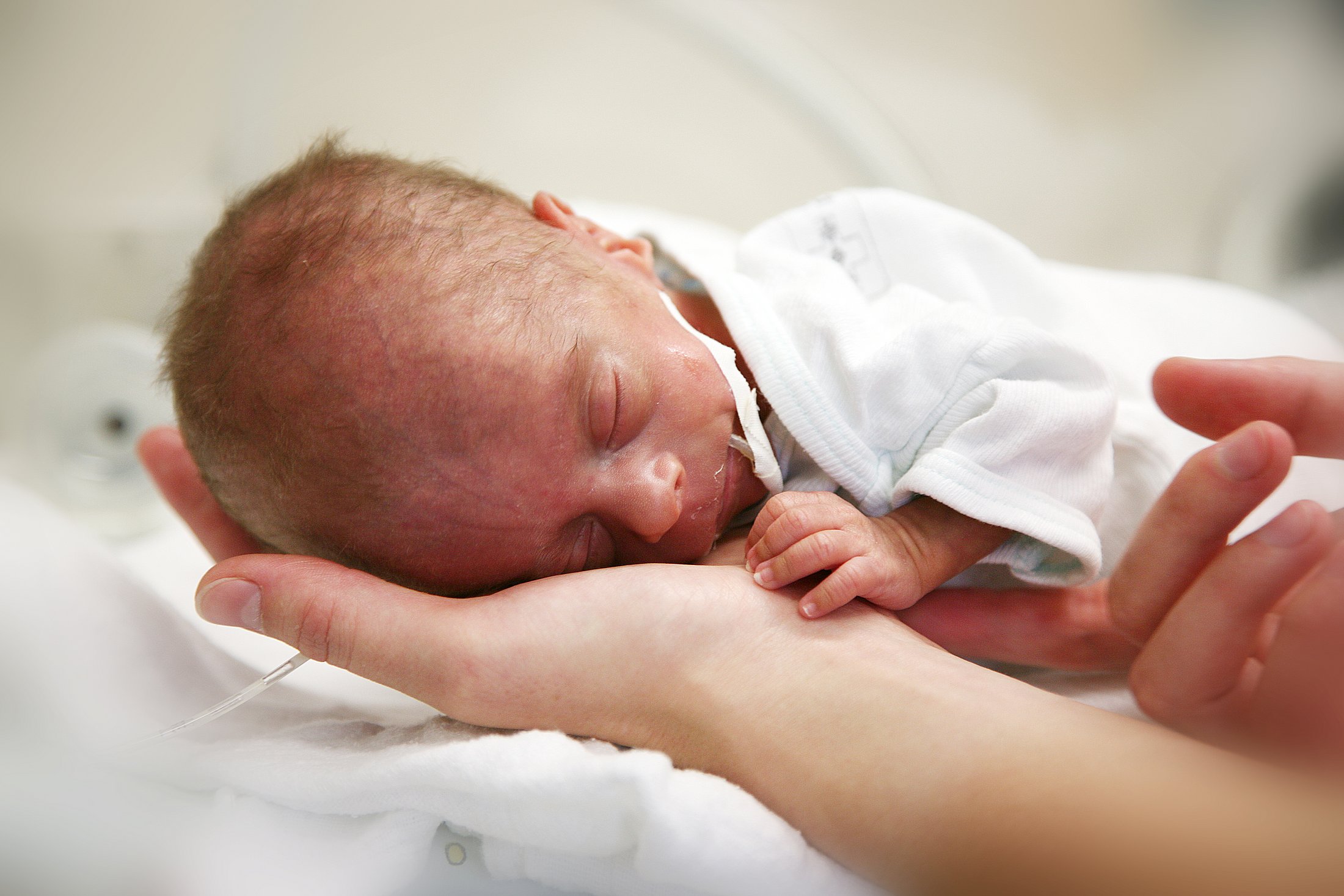 Preterm Infant Resting in a Caregiver’s Hand Very small preterm infant sleeping in a caregiver’s hand in a neonatal care setting.