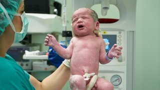 Umbilical Cord Management During Newborn Resuscitation: Is Delayed Clamping a Safe Option?