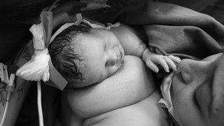 The Power of Kangaroo Mother Care: Improving Breastfeeding and Growth in Low-Birth-Weight Infants