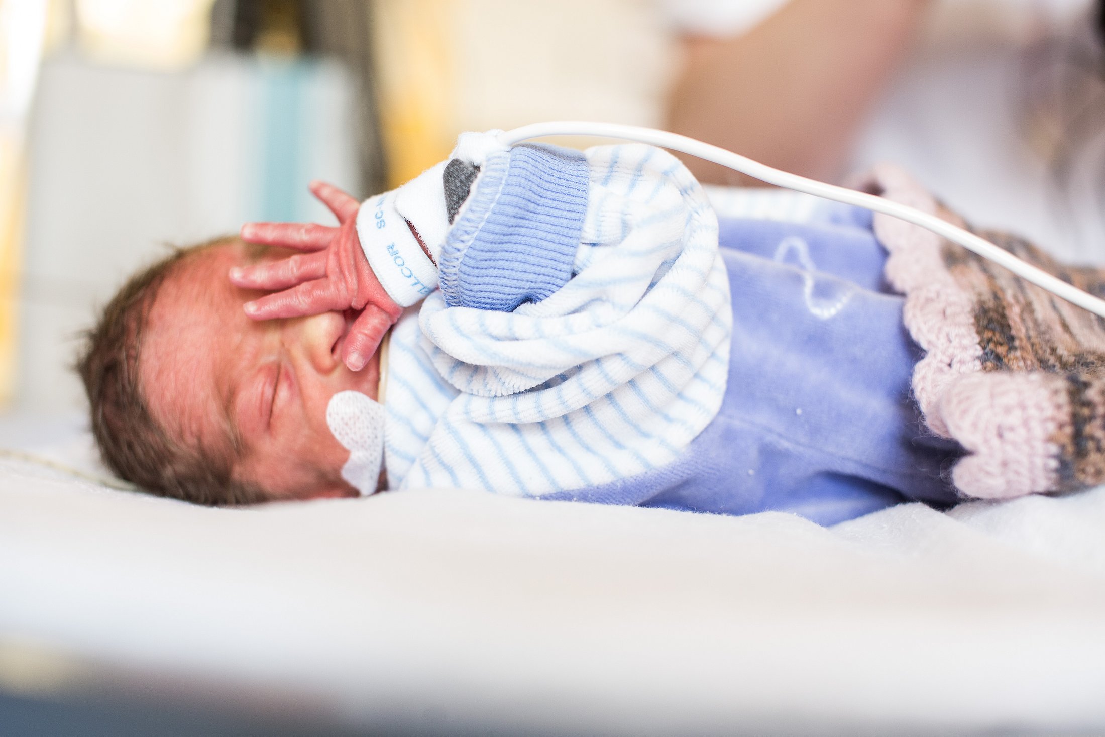 Preterm Infant Receiving Neonatal Care Preterm infant wearing blue clothing and connected to monitoring equipment in a neonatal unit.