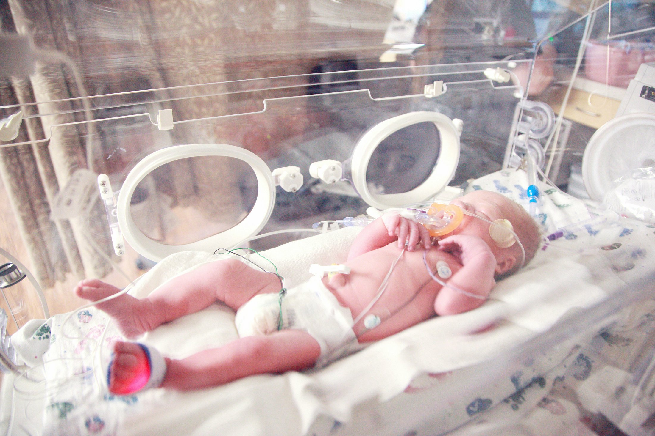 Preterm infant lying in a NICU incubator while receiving respiratory support and being monitored with medical sensors.