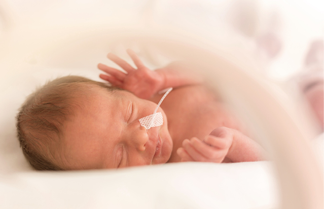 Newborn baby with a feeding tube receiving medical care after delivery.