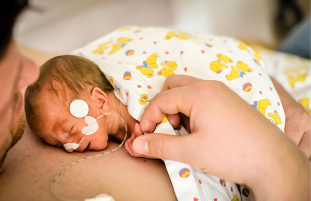 A premature newborn receiving kangaroo care, resting on a parent's chest with a feeding tube.