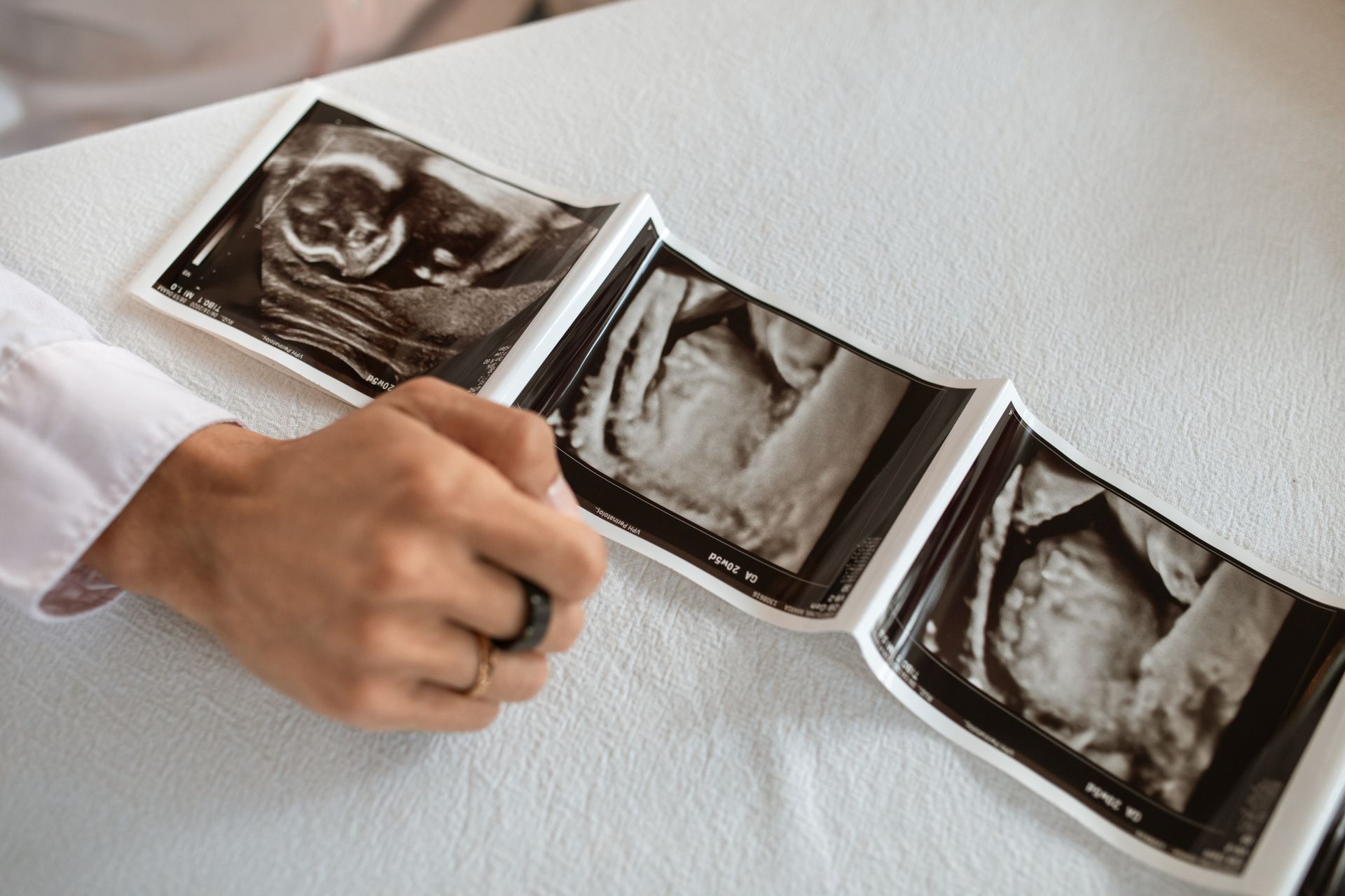 Prenatal Ultrasound and Fetal Development Healthcare professional points to a series of printed prenatal ultrasound images on an examination table.