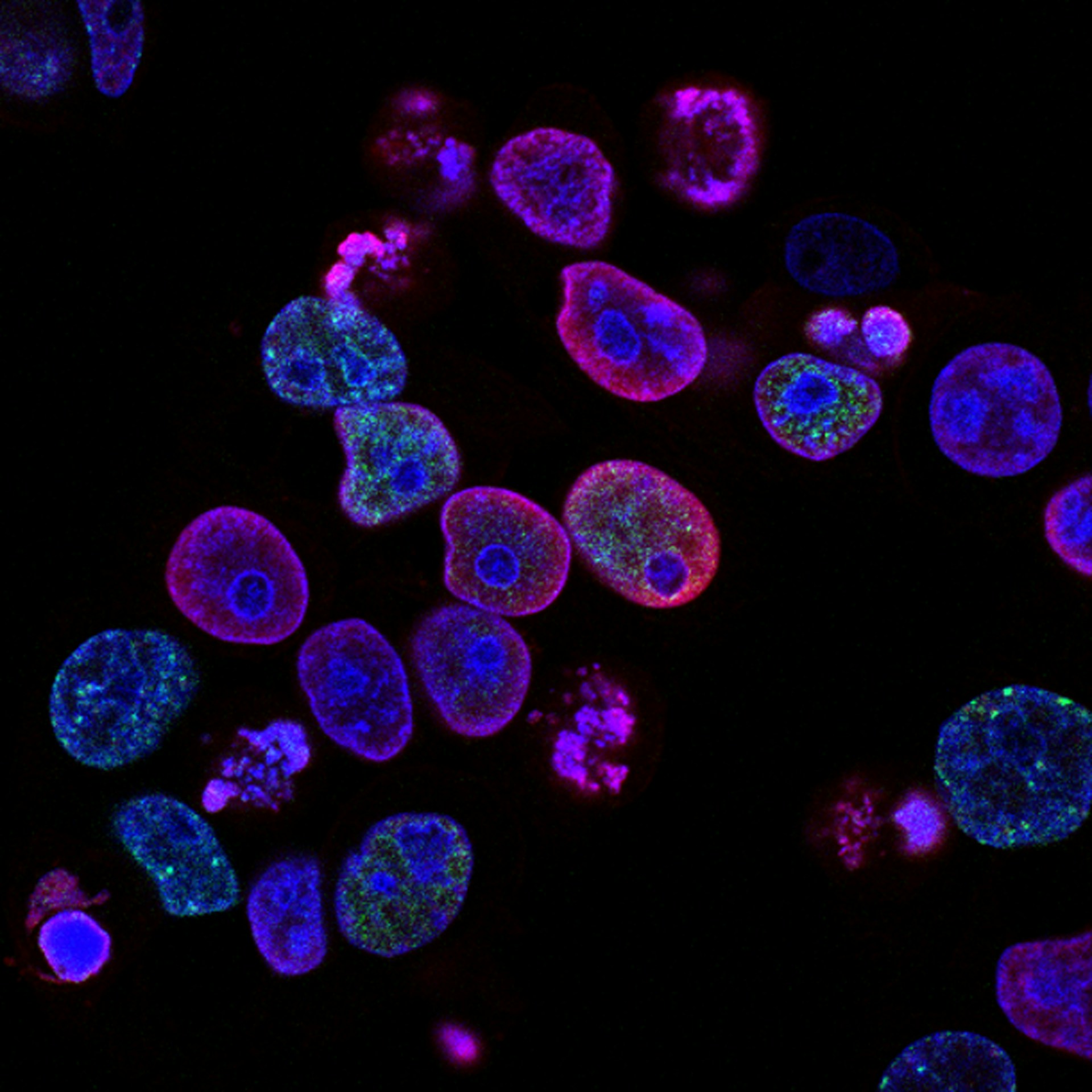 Biomedical Research and Preterm Birth Fluorescent microscopy image showing cells in purple, blue, pink, and green against a black background.