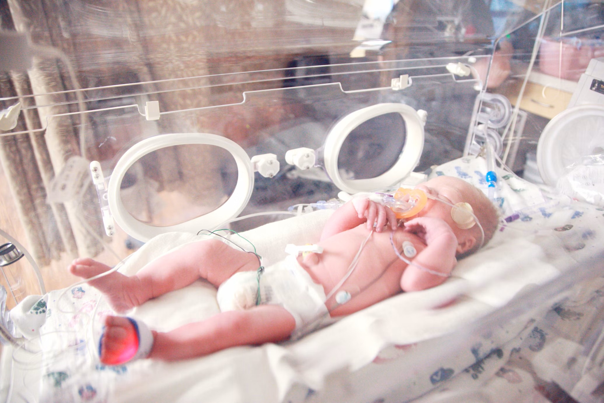 A premature newborn lies in a hospital incubator, connected to various monitors and medical tubes, receiving respiratory support and intensive care in a neonatal unit.